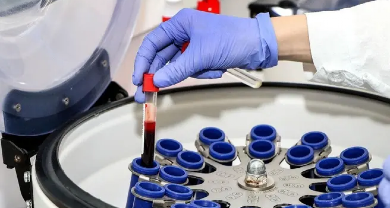 В Нижегородской области за 35 лет выявили почти 38 тысяч случаев ВИЧ-инфекции