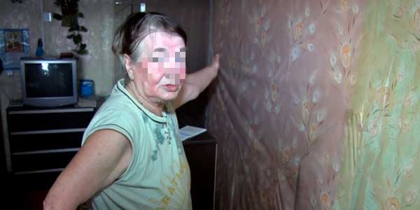 Пожилая дзержинка вынуждена жить в квартире с плесенью с детьми-инвалидами