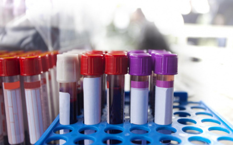 Ещё трое нижегородцев скончались от коронавируса