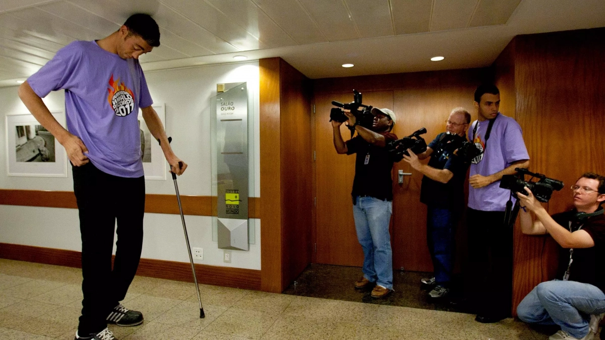 Рос по 12–14 сантиметров в год: как живут люди с акромегалией
